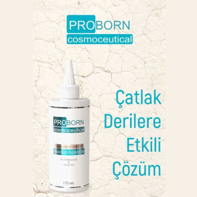 PROBORN Cracked Skin Remover Topuk Soyucu Losyon Çatlak Deri Balsamı 175ml PROBORN Cracked Skin Remover Topuk Soyucu Losyon Çatlak Deri Balsamı 175ml