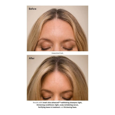 Aveda Invati Ultra Advanced Dökülme Karşıtı Saç Serumu 30ml